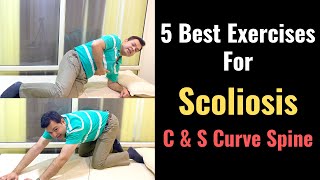 5 Best Exercises for Scoliosis How to Correct Scoliosis Stretches for Scoliosis Spinal Curvature [upl. by Haonam28]