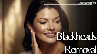 Skincare  Blackheads Removal 084 skincare skincare blackheads blackheads [upl. by Hareemas]