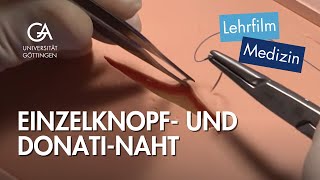 Einzelknopf und DonatiNaht [upl. by Einhapets72]