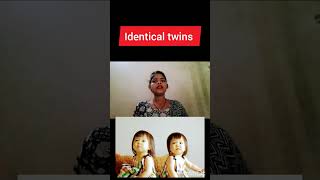 monochorionoc Diamniotic twins pregnancy kya hoti hai identical twins pregnancy dizygotic twins preg [upl. by Camp]