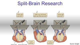 Split Brain SyndromeExplained [upl. by Ahseined721]