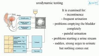 urodynamic testing [upl. by Yun]