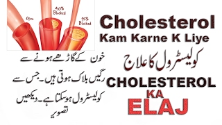 Cholesterol Kam Karne ke Liye  Urdu Main Sub Kuch [upl. by Ocana]