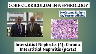 Interstitial Nephritis4 Chronic Interstitial Nephritis part 2 DrOssama Elkholy [upl. by Bryana]