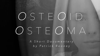 OSTEOID OSTEOMA A Short Documentary Film [upl. by Hsaka851]