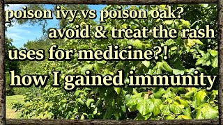 Poison ivy  oak  sumac ID remedies medicinal uses amp immunity [upl. by Vish]