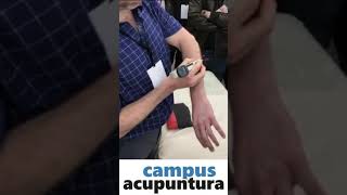 Estimulación NeuroRefleja sobre puntos de acupuntura  Campus Acupuntura [upl. by Lomax532]