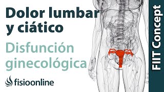 Disfunciones ginecológicas y dolor de espalda lumbar y ciático  Causas y tratamiento [upl. by Ennaylloh]