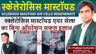 मल्टीपल स्क्लेरोसिस ट्रीटमेंट  sclerosis mastoid air cells ka ilaj  without surgery  homeopathy [upl. by Magnolia]