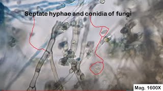 Septate hyphae and conidia of fungi [upl. by Tyne]