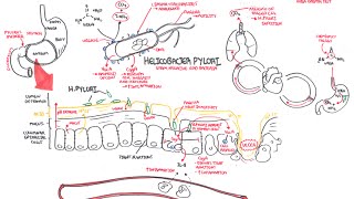 Microbiology  Helicobacter Pylori Ulcer [upl. by Auhsuoj935]