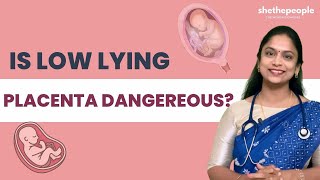 Can Low Lying Placenta Harm Your Fetus  She The People [upl. by Hsan]