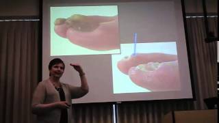 Routine Toenail Debridement [upl. by Aremaj114]