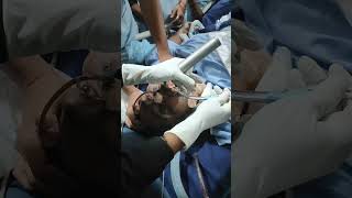 endotracheal intubation [upl. by Hueston]