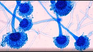 Slide culture technique  microculture of filamentous fungi in mycology molds [upl. by Arlena]