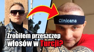 ZROBIŁEM PRZESZCZEP WŁOSÓW W TURCJI  VLOG odc 1 [upl. by Nirej]