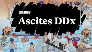 Ascites Diagnosis Causes amp DDx Guide Part 1  Sketchy Medical  USMLE Step 2 CK [upl. by Esidnac934]