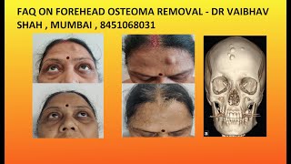 Frequently asked Questions on Forehead osteoma removal surgery in India [upl. by Modeerf]