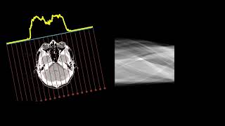 Xray tomography sinogram buildup [upl. by Eiramoj370]