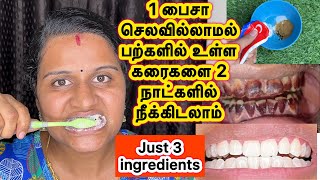 Teeth whitening at homeWhitening teeth home RemediesHow to whiten teethbhuvana pandi lifestyle [upl. by Meesan]