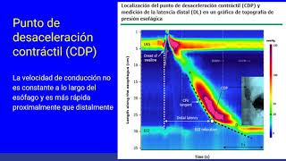 Manometría Esofágica de alta Resolución Parte I [upl. by Shaer721]