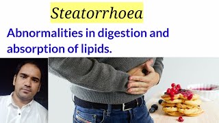 Steatorrhea  What is steatorrhea  Abnormal Lipid digestion  Fat in fecal matter  Fat excretion [upl. by Nitsruk677]