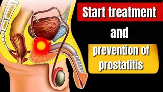 Effective Treatment and Prevention Tips for Prostatitis A Comprehensive Guidequot [upl. by Aicire]