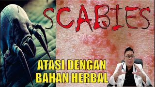 SCABIES ATASI DENGAN MENGGUNAKAN BAHAN HERBAL [upl. by Asiral]