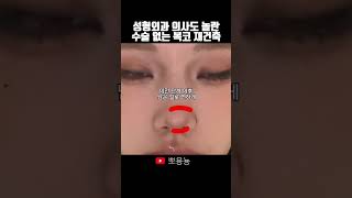 복코성형보다 복코쉐딩이 효과적입니다 makeup 메이크업 복코성형 복코쉐딩 [upl. by Katusha519]