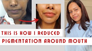 This is How I removed pigmentation around mouth  Get rid of even dullness [upl. by Osnerol685]