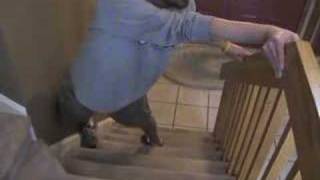 LimbGirdle Muscular Dystrophy 2A Stair Climbing Part 1 [upl. by Marylinda]