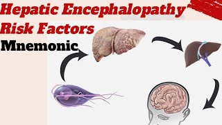 Hepatic Encephalopathy Risk factors Mnemonic [upl. by Egres777]