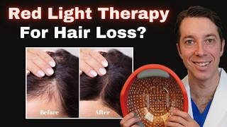 Does Red Light Therapy STOP Hair Loss [upl. by Nwahsaj]