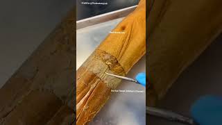 Real human leg skin layer Epidermis Dermis Hypodermis fat layer [upl. by Odrarebe]