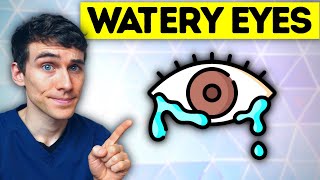 The 1 Best Watery Eyes Remedy causes and treatment  Eye Doctor Explains [upl. by Adihahs320]