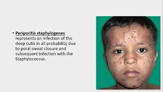 Lecture177 Miliaria Neutrophilic Eccrine hidradenitis amp Disorders of Apocrine glands Rook Ch 94 [upl. by Sivel105]