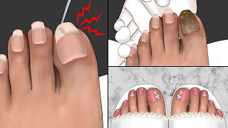 ASMR Foot Care Animation for a Photo Shoot🦶 Athletes foot Treatment Pedicure Makeup [upl. by Still]