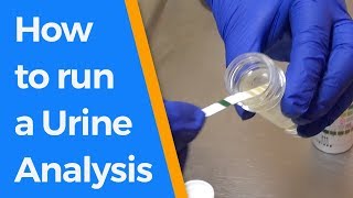 How to run a Urine Analysis [upl. by Ellivnarg]