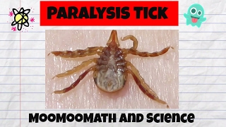 Ticks in AustraliaParalysis Tick [upl. by Norvil]