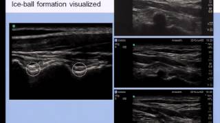 Pain Medicine  Role of Ultrasound Imaging in Neuraxial Pain Procedures [upl. by Camilla708]