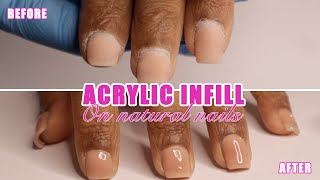 Acrylic overlay nail infill tutorial  self taught nail technician [upl. by Mcconaghy]