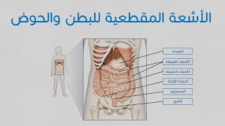 الأشعة المقطعية للبطن والحوض [upl. by Reginauld]