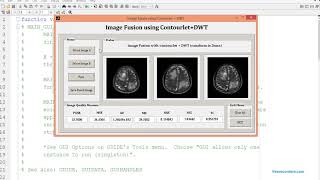 Image Fusion using Curvelet  DWT and Contourlet  DWT MATLAB code [upl. by Dewey]