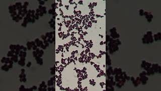 Gram Staining Insights Identifying Staphylococcus hominis as GPC in Singles Pairs and Clusters [upl. by Selec]