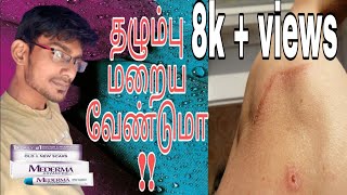 Mederma cream in tamil  mederma cream review in tamil  yogesh meditech [upl. by Enyrhtak644]