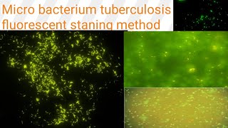 AuramineRhodamine staining on fluorescent microscopy Diagnosis of TB Microbacterium tuberculosis [upl. by Destinee]