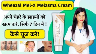 Wheezal MelX Cream Uses in Hindi  Wheezal MelX Cream Review  Mel X Cream  Mel X Melasma Cream [upl. by Arba]