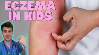 Everything you need to know about Eczema in kids Causes symptoms treatment amp home management [upl. by Aikemaj]