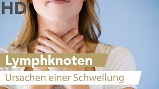 Ständig geschwollene Lymphknoten Mögliche Ursachen und Hilfe [upl. by Hakym]