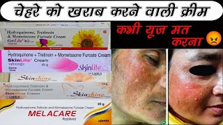 Kya ye sab cream lagana sahi hai  😡 Fairness Cream के Side Effects और उनका इलाज [upl. by Favrot944]